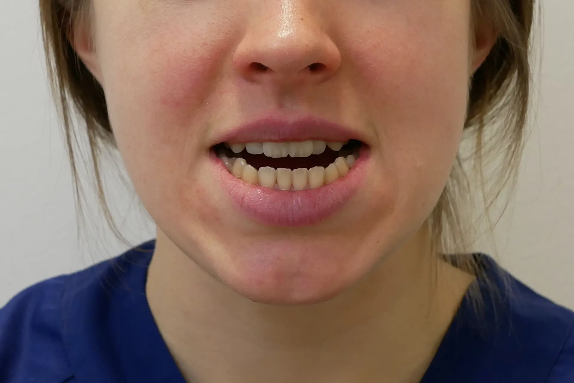 A close up of a woman