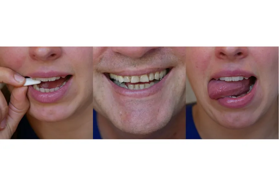 A collage of a man's face